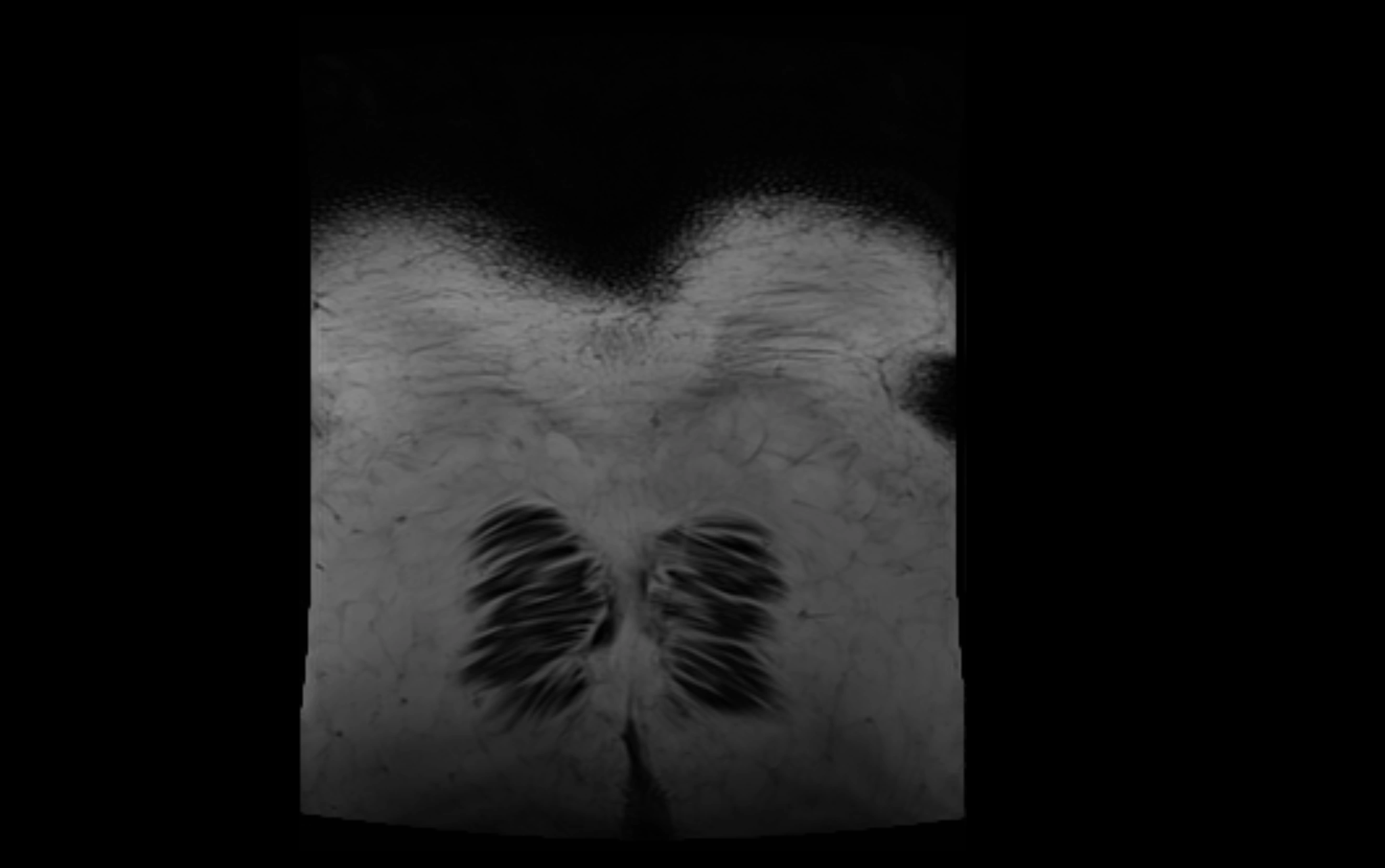 MR lumbosacral plexus cross sectional anatomy 3T  radiology  image-img-09001-00092.webp